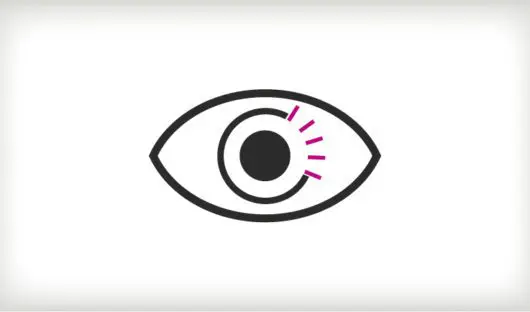 Icon representing retinoblastoma