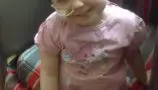 Ruby whilst she was on treatment.