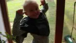 Kate as a child with a shaved head during cancer treatment.