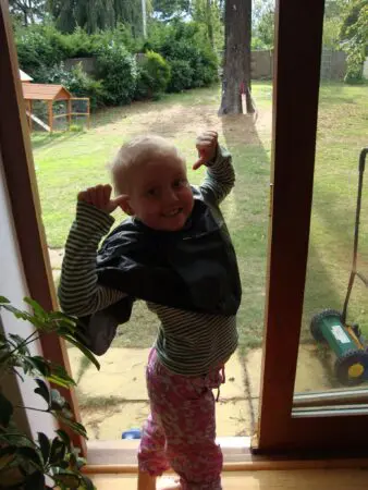 Kate as a child with a shaved head during cancer treatment.