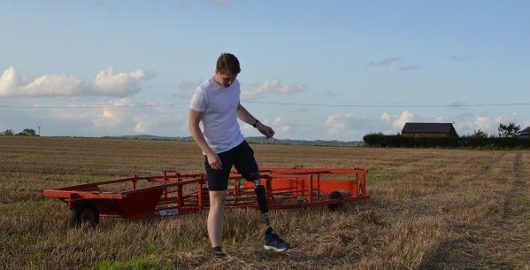 Chris getting used to his prosthetic leg