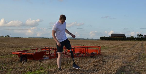 Chris getting used to his prosthetic leg