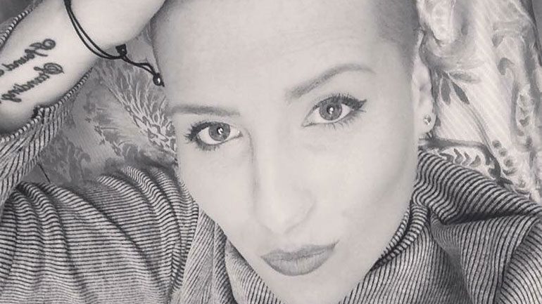 Madison, after she lost her hair